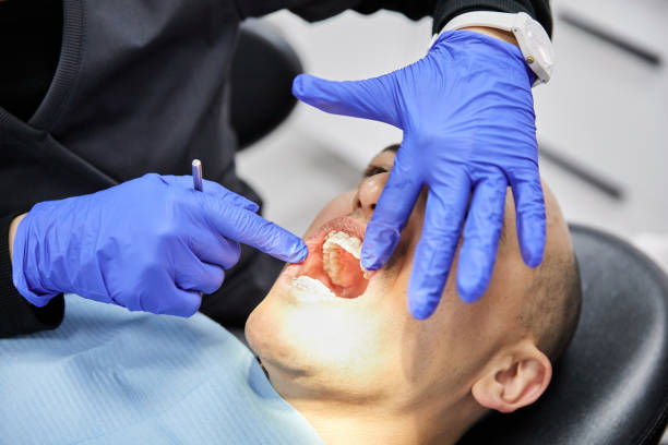 Best Broken or Chipped Tooth Repair in East Providence, RI