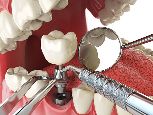 Best Emergency Cosmetic Dentistry (e.g., broken veneers) in East Providence, RI