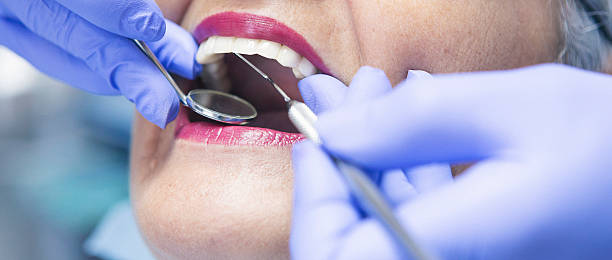 Best Emergency Care for Gum Disease in East Providence, RI